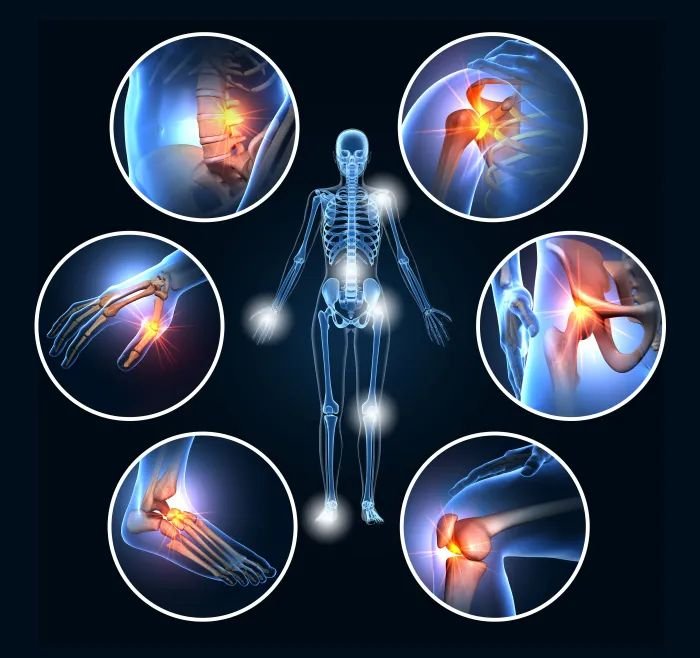 Skeletal Muscle Relaxants